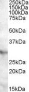 NAD(P)HX Epimerase antibody, PA5-18975, Invitrogen Antibodies, Western Blot image 