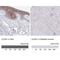 Claudin 1 antibody, NBP2-38578, Novus Biologicals, Immunohistochemistry paraffin image 