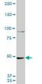 Metastasis Associated 1 antibody, H00009112-M10, Novus Biologicals, Western Blot image 