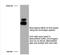 COP9 Signalosome Subunit 5 antibody, NB200-312, Novus Biologicals, Western Blot image 