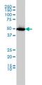 Solute Carrier Family 45 Member 2 antibody, H00051151-M01, Novus Biologicals, Western Blot image 