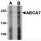 ATP Binding Cassette Subfamily A Member 7 antibody, MBS150228, MyBioSource, Western Blot image 