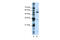 KH RNA Binding Domain Containing, Signal Transduction Associated 3 antibody, 29-385, ProSci, Enzyme Linked Immunosorbent Assay image 