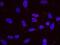 Tyrosyl-DNA Phosphodiesterase 1 antibody, NB100-81642, Novus Biologicals, Proximity Ligation Assay image 