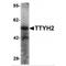 Tweety Family Member 2 antibody, MBS150067, MyBioSource, Western Blot image 