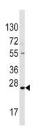 Sclerostin antibody, abx032756, Abbexa, Immunohistochemistry paraffin image 