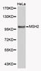 MutS Homolog 2 antibody, abx000543, Abbexa, Western Blot image 