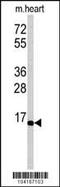 Ubiquitin Conjugating Enzyme E2 G1 antibody, MBS9212941, MyBioSource, Western Blot image 