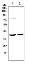 Histone Deacetylase 11 antibody, PB9630, Boster Biological Technology, Western Blot image 