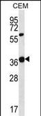 Wnt Family Member 16 antibody, A03606-1, Boster Biological Technology, Western Blot image 