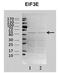 Eukaryotic Translation Initiation Factor 3 Subunit E antibody, orb330532, Biorbyt, Western Blot image 
