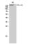 Collagen Type XI Alpha 1 Chain antibody, STJ92373, St John