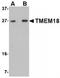 Transmembrane Protein 18 antibody, TA306729, Origene, Western Blot image 