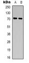 Immunoglobulin Superfamily Member 8 antibody, LS-C368970, Lifespan Biosciences, Western Blot image 