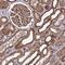 SYF2 Pre-MRNA Splicing Factor antibody, NBP1-92463, Novus Biologicals, Immunohistochemistry paraffin image 