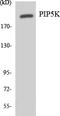 Phosphoinositide Kinase, FYVE-Type Zinc Finger Containing antibody, LS-C200489, Lifespan Biosciences, Western Blot image 