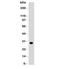 HLA class II histocompatibility antigen, DRB1-15 beta chain antibody, orb385861, Biorbyt, Western Blot image 