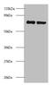 Ribosomal Protein S10 antibody, orb239000, Biorbyt, Western Blot image 