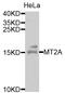 Metallothionein 2A antibody, STJ24624, St John