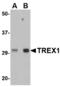 Three Prime Repair Exonuclease 1 antibody, A00940, Boster Biological Technology, Western Blot image 