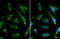 Acyl-CoA Dehydrogenase Very Long Chain antibody, GTX114232, GeneTex, Immunocytochemistry image 