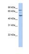 Casein Kinase 1 Epsilon antibody, orb330653, Biorbyt, Western Blot image 