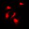 Ribosomal Protein S6 Kinase B1 antibody, orb214537, Biorbyt, Immunofluorescence image 