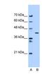 Adipocyte Plasma Membrane Associated Protein antibody, NBP1-59984, Novus Biologicals, Western Blot image 