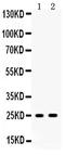 Prostate Stem Cell Antigen antibody, PB9351, Boster Biological Technology, Western Blot image 