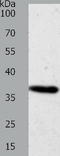 Aldose reductase antibody, TA323141, Origene, Western Blot image 