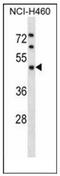 Kaptin, Actin Binding Protein antibody, AP52403PU-N, Origene, Western Blot image 