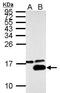 Galectin 7B antibody, GTX125900, GeneTex, Western Blot image 
