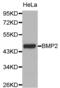 Bone Morphogenetic Protein 2 antibody, AHP2442, Bio-Rad (formerly AbD Serotec) , Western Blot image 