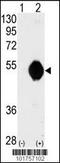 Docking Protein 2 antibody, 63-148, ProSci, Western Blot image 