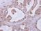 Cyclin And CBS Domain Divalent Metal Cation Transport Mediator 4 antibody, NBP2-15927, Novus Biologicals, Immunohistochemistry paraffin image 