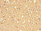 DnaJ Heat Shock Protein Family (Hsp40) Member C6 antibody, LS-C396332, Lifespan Biosciences, Immunohistochemistry paraffin image 