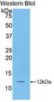 S100 Calcium Binding Protein A5 antibody, abx132054, Abbexa, Western Blot image 