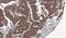 Atypical Chemokine Receptor 3 antibody, GTX100027, GeneTex, Immunohistochemistry paraffin image 