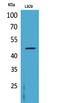 Colony Stimulating Factor 2 Receptor Alpha Subunit antibody, A04432, Boster Biological Technology, Western Blot image 