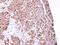 Leucine Rich Pentatricopeptide Repeat Containing antibody, LS-C186078, Lifespan Biosciences, Immunohistochemistry paraffin image 