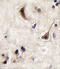 Protein Tyrosine Phosphatase Non-Receptor Type 5 antibody, abx033947, Abbexa, Immunohistochemistry paraffin image 