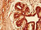 Keratin 81 antibody, CSB-PA012576LA01HU, Cusabio, Immunohistochemistry paraffin image 