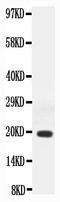 Interferon Gamma antibody, LS-C313427, Lifespan Biosciences, Western Blot image 