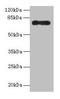 Arachidonate 15-Lipoxygenase Type B antibody, LS-C369220, Lifespan Biosciences, Western Blot image 