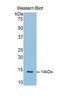 Hemoglobin Subunit Alpha 2 antibody, LS-C294442, Lifespan Biosciences, Western Blot image 