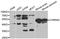 Cholinergic Receptor Nicotinic Alpha 5 Subunit antibody, MBS127313, MyBioSource, Western Blot image 