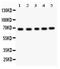 Acetylcholinesterase antibody, PB9417, Boster Biological Technology, Western Blot image 