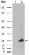 Crystallin Alpha B antibody, STJ97971, St John