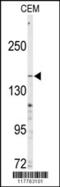 ATP Binding Cassette Subfamily C Member 4 antibody, 62-908, ProSci, Western Blot image 