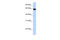 Kelch Like Family Member 36 antibody, 25-216, ProSci, Western Blot image 